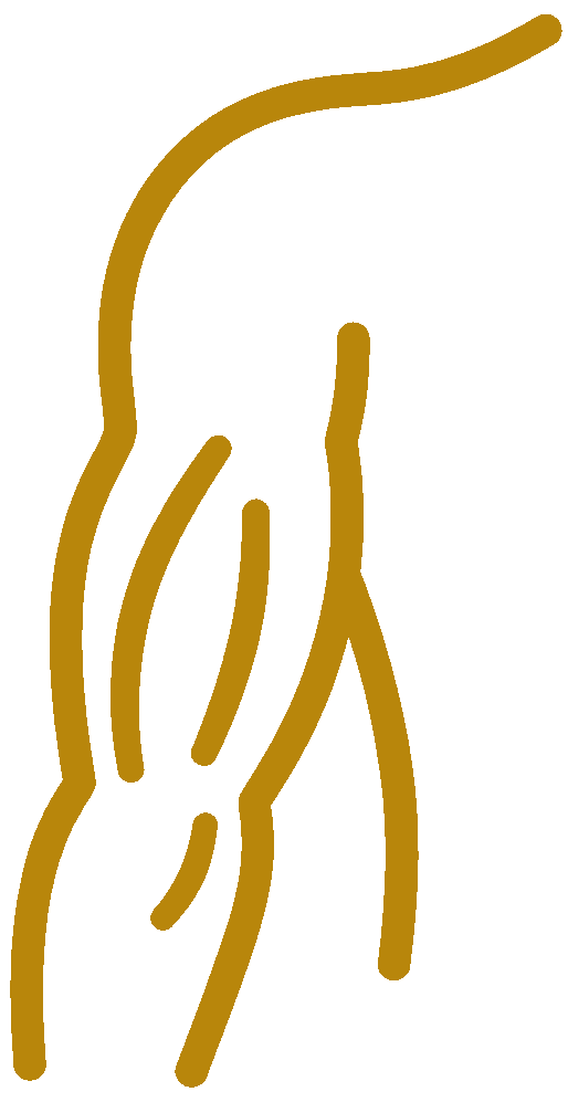 Tríceps